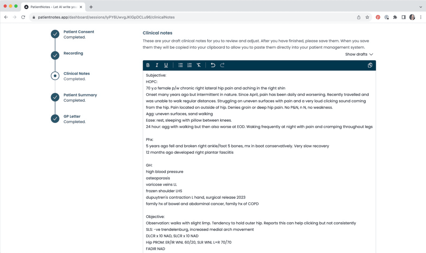 Screenshot of PatientNotes showing generated clinical notes